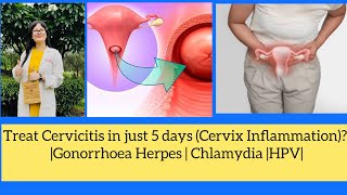 Cervix infection chlamydia HPV  Gonorrhoea Homeopathic Medicines For CervicitisDr Rukmani [upl. by Lemra]