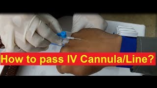 How to Pass IV Cannula [upl. by Cumine]