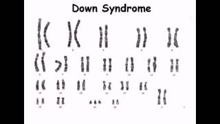 8 Karyotype [upl. by Acilef]