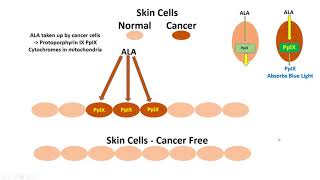 Photodynamic Therapy [upl. by Shelby]