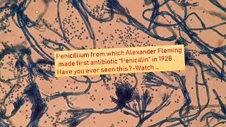 Penicillium under the Microscope [upl. by Holihs]