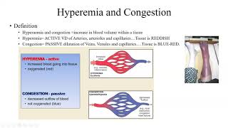 Pathology Made Easy 4 Hemodynamic Disorders [upl. by Enrika714]