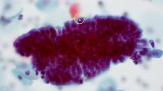 Cervical cytology  Endocervical cells [upl. by Esinehc]