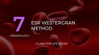 ESR Westergran Method [upl. by Acinorrev]