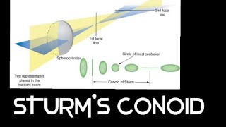 STURMS CONOID IN ENGLISH [upl. by Streetman]