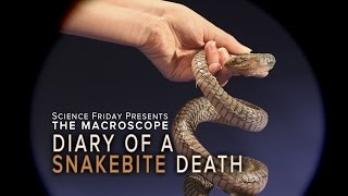 Diary of A Snakebite Death [upl. by Calv740]