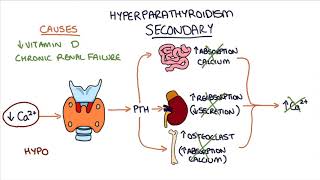 Understanding Hyperparathyroidism [upl. by Essie546]