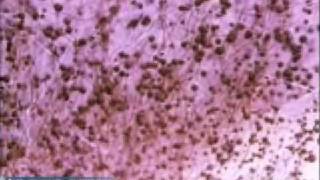 Penicillium Mold Growth [upl. by Eked100]