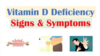 Vitamin D Deficiency Signs amp Symptoms ex Fatigue Diagnosis Treatment [upl. by Hershell]