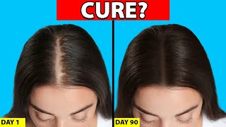 Womens Hair Loss Treatments That ACTUALLY WORK [upl. by Cordeelia]