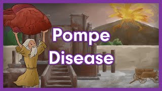 Pompe Disease  Glycogen Storage Disease Mnemonic for USMLE [upl. by Llerrit350]