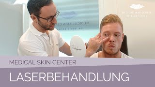 Laserbehandlung im Medical Skin Center – Dr Bacman [upl. by Novelc]