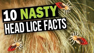 10 Facts You Dont Want to Know about Head Lice [upl. by Anilorac]