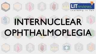 Internuclear Ophthalmoplegia [upl. by Austin]