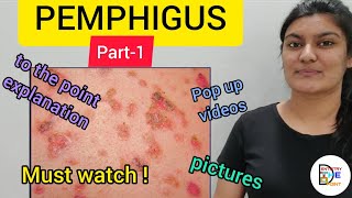 SKIN LESIONS PEMPHIGUS PART1 [upl. by Reinnej86]