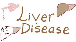 Liver Disease and Hemostasis Disorders [upl. by Aennaej]