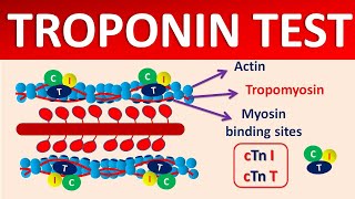 Troponin test and its significance [upl. by Htez]