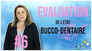 LÉvaluation de létat Buccodentaire  6  Formation Hygiène BuccoDentaire [upl. by Rauch]