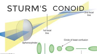 Sturms Conoid and shape of bundle of light rays at different levels [upl. by Lamont898]