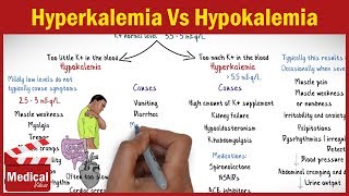 Hyperkalemia Vs Hypokalemia  EASY TO REMEMBER [upl. by Edmanda]