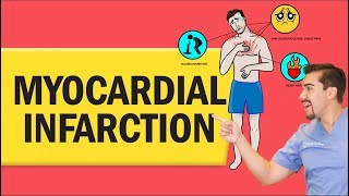 Myocardial Infarction Heart Attack for Nursing amp NCLEX [upl. by Zipah]