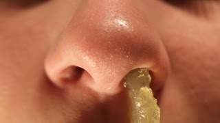 Huge Booger Removal [upl. by Bove411]