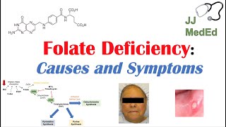 Folate Deficiency Causes ex medications Pathogenesis Symptoms Diagnosis and Treatment [upl. by Umont]