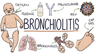 Understanding Bronchiolitis [upl. by Spalding37]